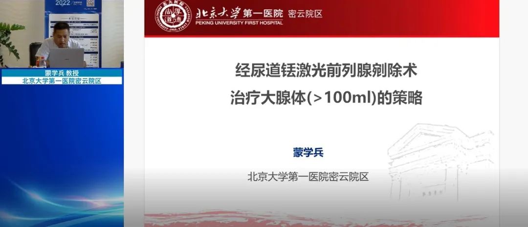 北京大學第一醫院密云院區 蒙學兵教授 分享“經尿道銩激光前列腺剜除術治療大腺體（≥100ml）的策略”,泌尿行,泌尿外科醫療設備,瑞柯恩