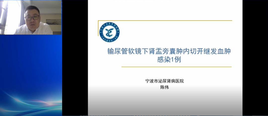 寧波市泌尿腎病醫院-陳偉教授,分享“輸尿管軟鏡下腎盂旁囊腫內切開繼發血腫感染1例”,泌尿行,泌尿外科醫療設備,瑞柯恩