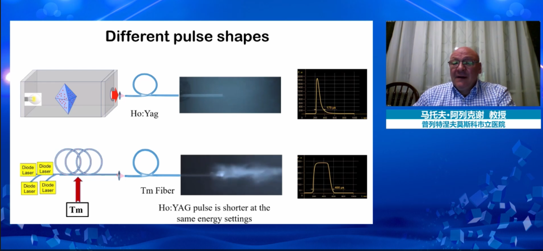 馬托夫·阿列可謝教授帶來“超脈沖光纖銩激光碎石術5年臨床經驗回顧”演講,光纖銩激光,銩激光,醫用銩激光,瑞柯恩